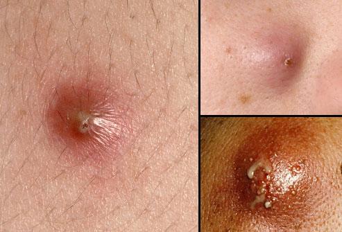 © Central Dermatology Center