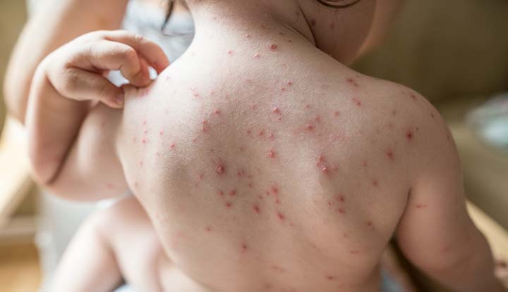 © Health Central